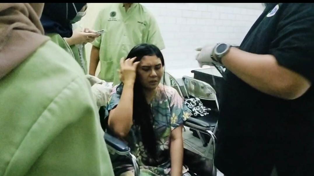 LUKA : DJ Nana Rolex di Surabaya, diduga menjadi korban penganiayaan suami siri yang merupakan anggota DPRD Sampang.  &nbsp;
