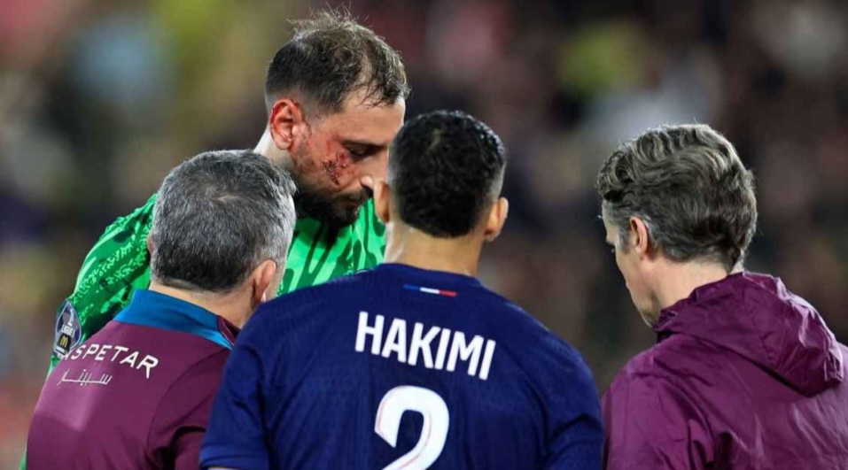 Gianluigi Donnarumma  terpaksa keluar lapangan setelah 22 menit dan membutuhkan 10 operasi akibat cedera.