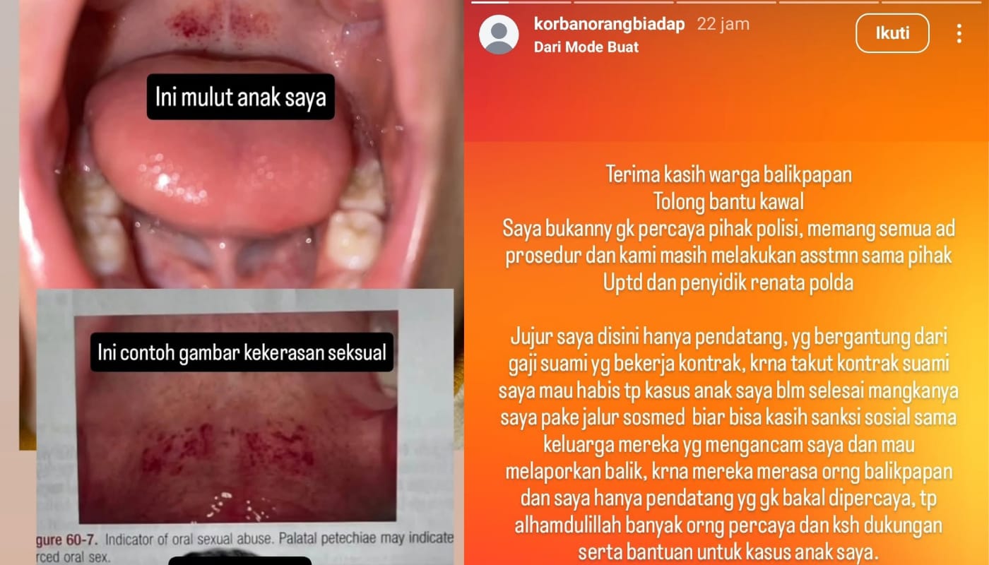 Bukti bukti pelecehan seksual yang dialami korban.