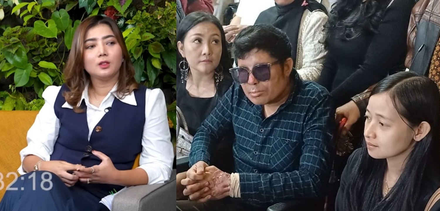 Pratiwi Noviyanthi (kiri), korban penyiraman air keras, Agus Salim tak ikhlas uang donasi dialihkan ke korban letusan gunung berapi Lewotobi Laki-Laki di NTT.
