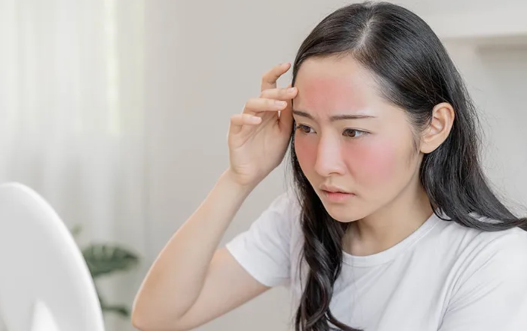 Pemilik kulit sesnsitif harus memperhatikan baik-baik dalam memilih skincare dan kosmetik agar tidak membuat kulit iritasi.