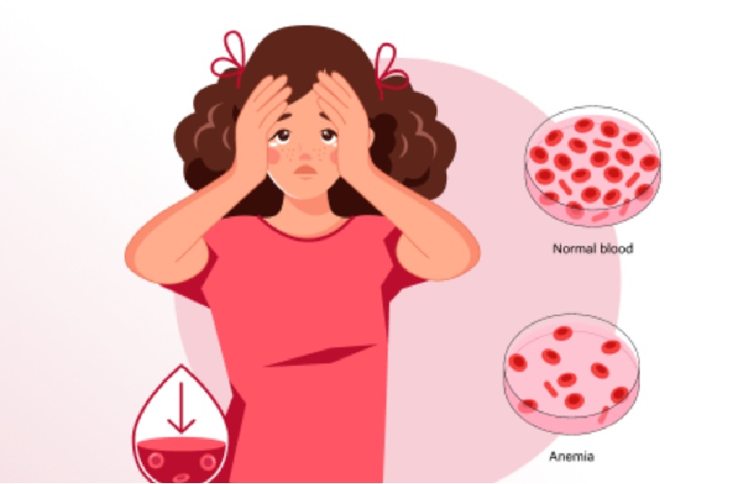 Ilustrasi anemia.