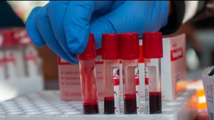 Berdasarkan data Kementerian Kesehatan Republik Indonesia, lebih dari 540 ribu kasus HIV telah terdeteksi di berbagai wilayah Nusantara.