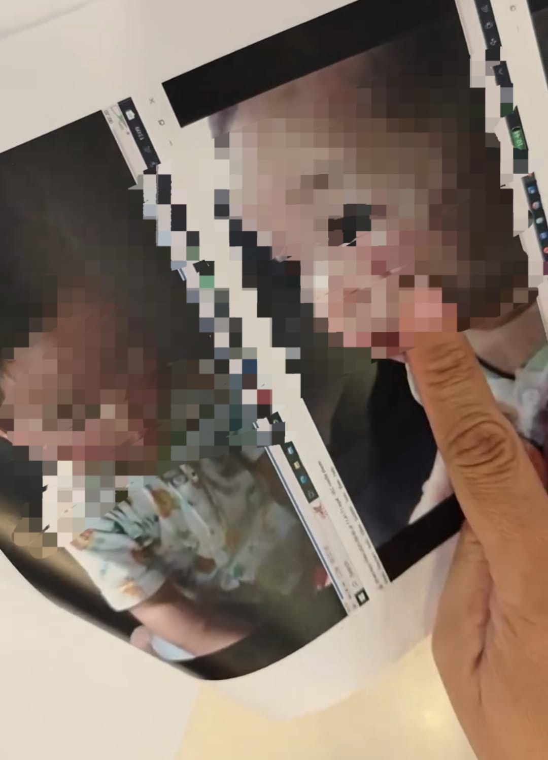 TERLUKA: Kondisi korban balita mengalami luka. Ia diduga menjadi korban anak sebayanya saat ditinggal di daycare, Medokan Ayu, Rungkut, Surabaya.(IST/RADAR SURABAYA)