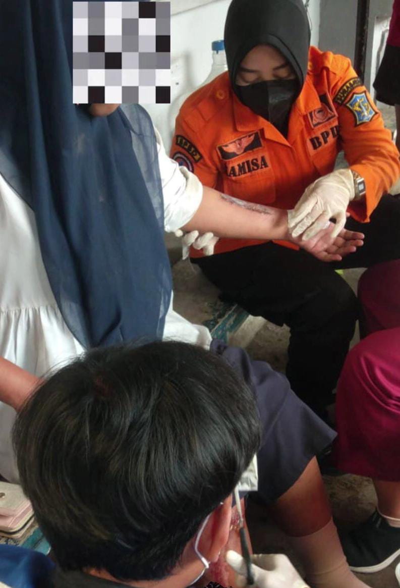 PENANGANAN: Korban LR, seorang mahasiswi saat mendapatkan perawatan medis usai dijambret di Jalan Jolotundo, Surabaya, Rabu (20/8).(IST/RADAR SURABAYA)