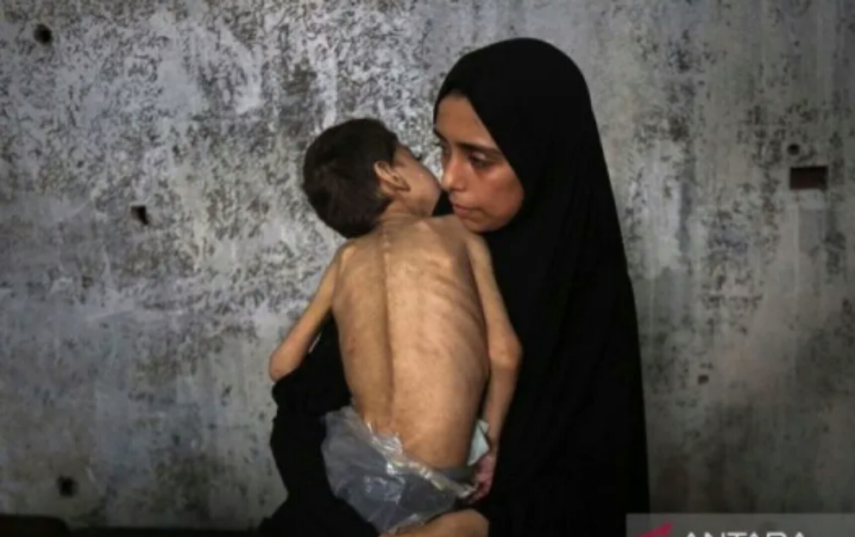 Anak Gaza Palestina jadi korban kelaparan akibat blokade Israel.