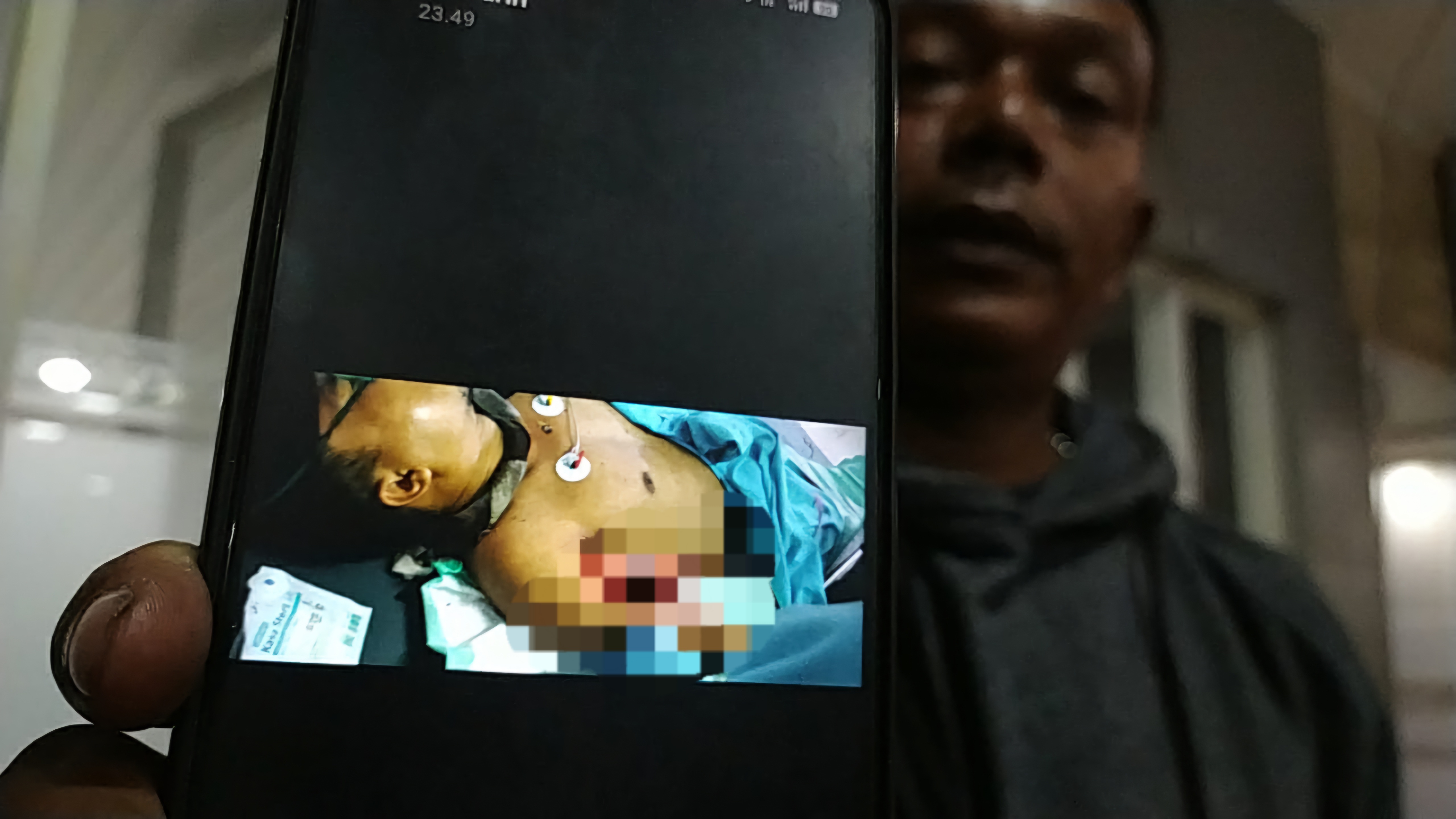 DIRAWAT : Keluarga korban menunjukkan kondisi korban ST dirawat di RSUD Dr Soewandi Surabaya. Ia menjadi korban pembacokan di pinggir Sungai Kalimas, Jalan Gemblongan, Surabaya. (IST/RADAR SURABAYA)