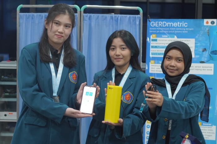 PENDETEKSI GERD: Tiga mahasiswa Program Studi Teknik Elektro Ubaya, menunjukkan Pendeteksi Gerd berbasis IoT karyanya di kampus setempat.