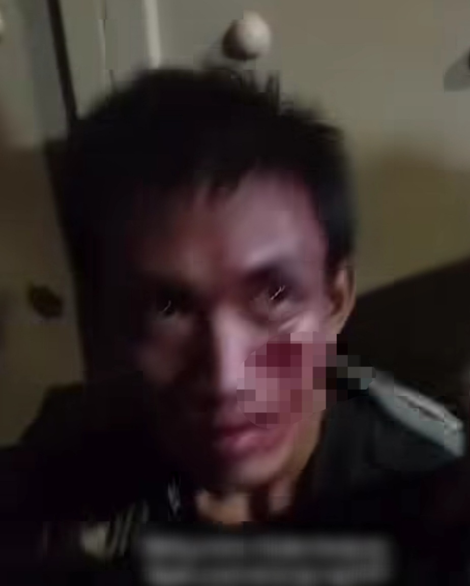 BABAK BELUR: Tersangka curanmor RQ usai dihajar massa saat ditangkap di Jalan Kenjeran, Surabaya.(IST/RADAR SURABAYA)