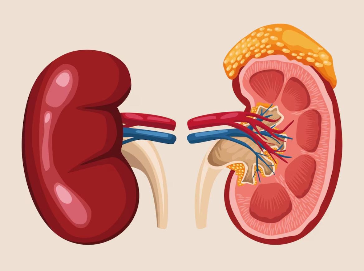 TB Ginjal: Penyakit ekstraparu yang menyerang organ ginjal.
