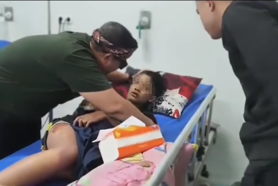 Kondisi NS saat masih hidup dan dibawa ke rumah sakit, tubuhnya penuh luka dan melepuh.
