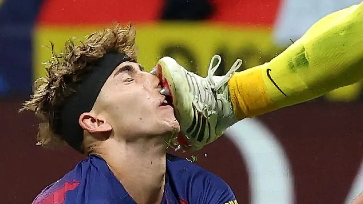 Fermin Lopez dihajar kiper Atletico Madrid tepat di wajah.(dailymail)