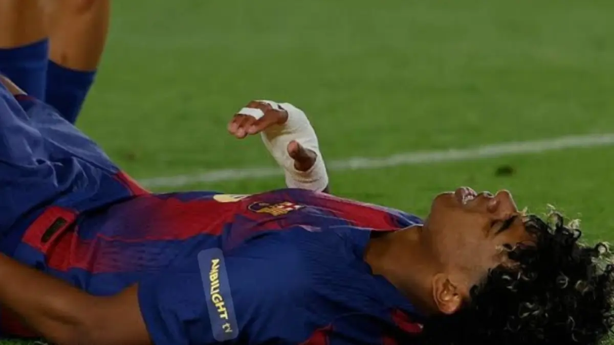 Lamine Yamal mengalami cedera hamstring saat lawan Celta Vigo. (Football Espana). 
