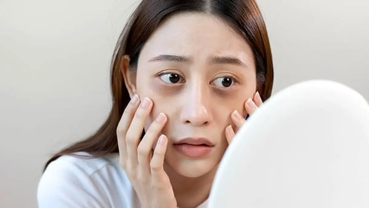 Faktor dibalik kantong mata menghitam, diantaranya kurang tidur! Foto: Pinterest.