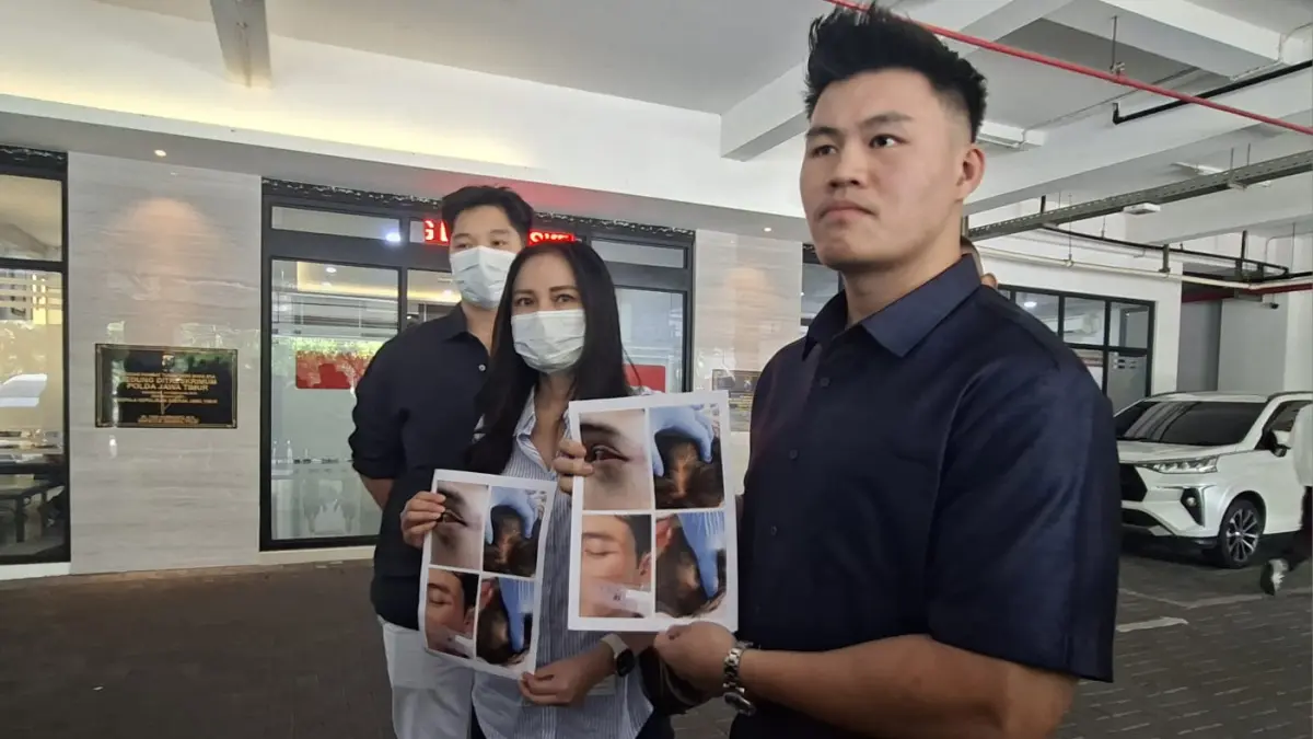LUKA: Kuasa hukum korban Matthew Jeremy (kanan) dan ibu korban Fanny Agustin menunjukkan foto korban pengeroyokan tiga tersangka di klub malam wilayah Surabaya Barat.(MAHRUS/RADAR SURABAYA)