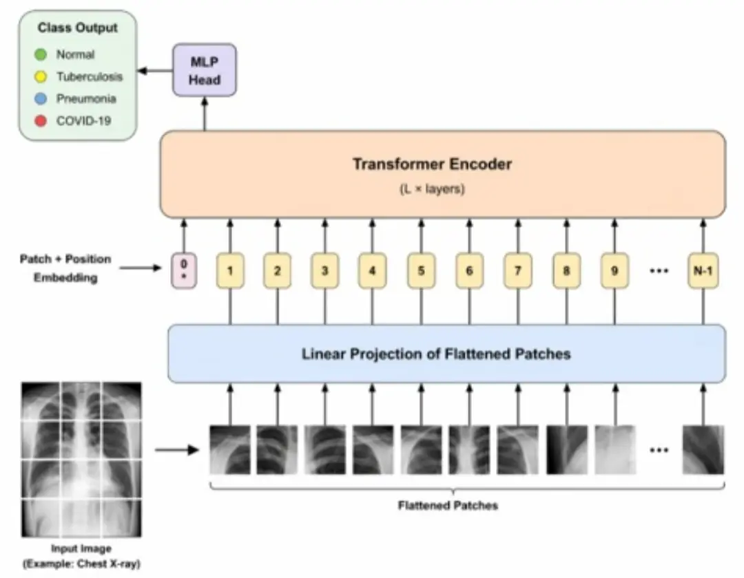 Arsitektur Vision Transformer (ViT) yang membagi citra X-ray dada menjadi beberapa patch untuk diklasifikasikan ke dalam empat kelas penyakit paru-paru.