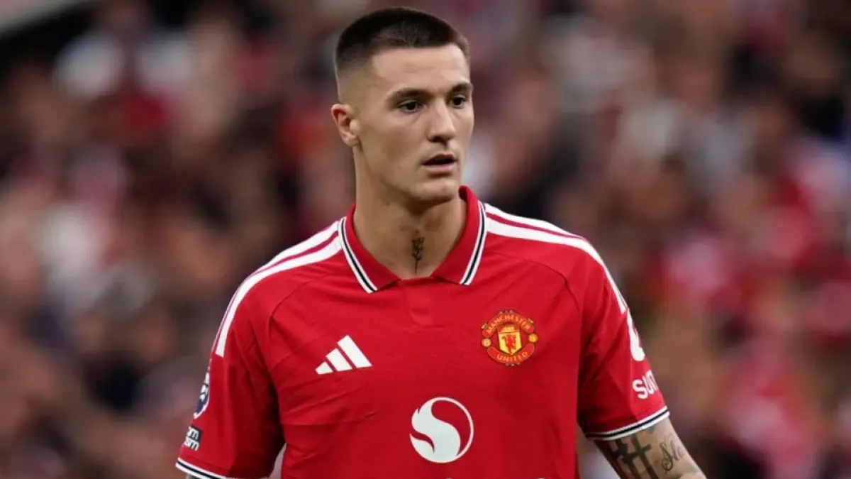 Benjamin Sesko cedera tulang kering. (Sport mole)