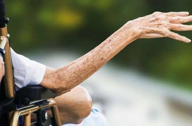 Jatim Penyumbang Penderita Kusta Baru Tertinggi