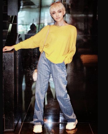 BERANI: Rina Nose buka suara soal gangguan kesehatan mental yakni obsessive compulsive disorder alias OCD. (INSTAGRAM)