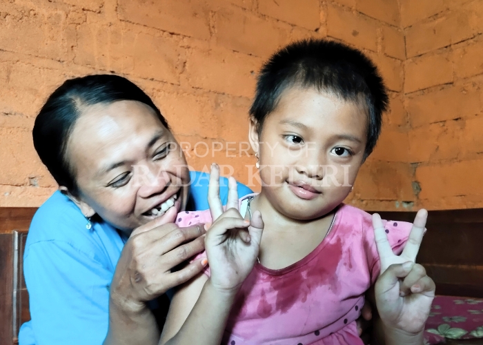 BUTUH BANTUAN: Patmirohmahbersama Alya Putri Farida yang menderitatumor otak. Siswa TK itu membutuhkan pengobatan lanjutan di RSUD Dr Soetomo Surabaya