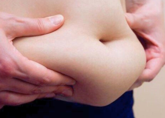 Ilustrasi perut buncit