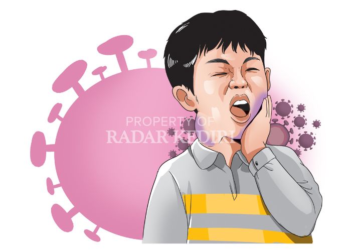 AWAS: Penyakit gondongan menyerang anak-anak. Di Kota Kediri sudah ratusan anak yang mengalami penyakit tersebut.