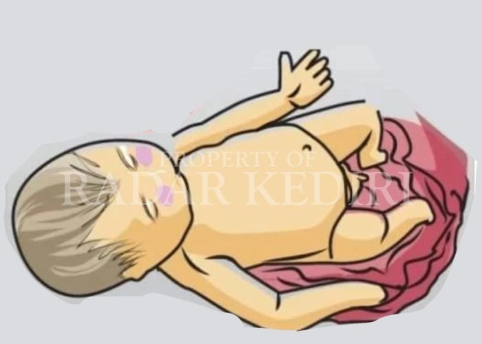ILUSTRASI: Kasus Buang Bayi di Desa Tunglur, KEcamatan Badas.