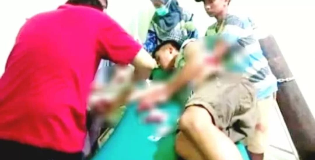 MS yang menjadi korban penganiyaan.