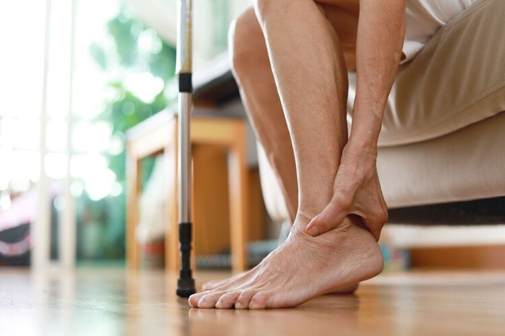 Ilustrasi Gejala Kolestrol pada kaki