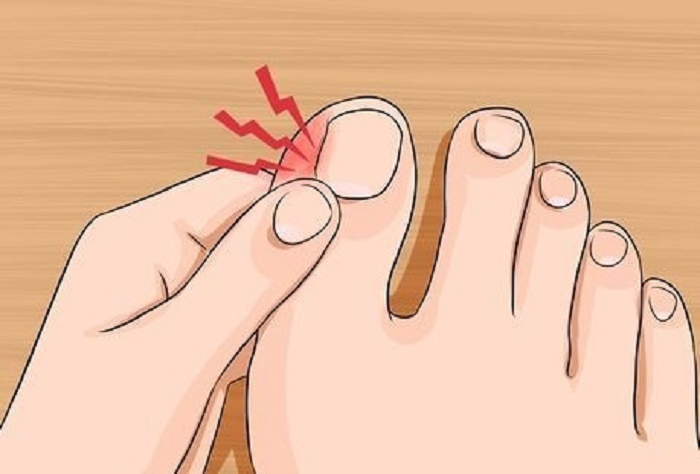 Hati-Hati! Cantengan Bisa Datang dari Rutinitas Sepele