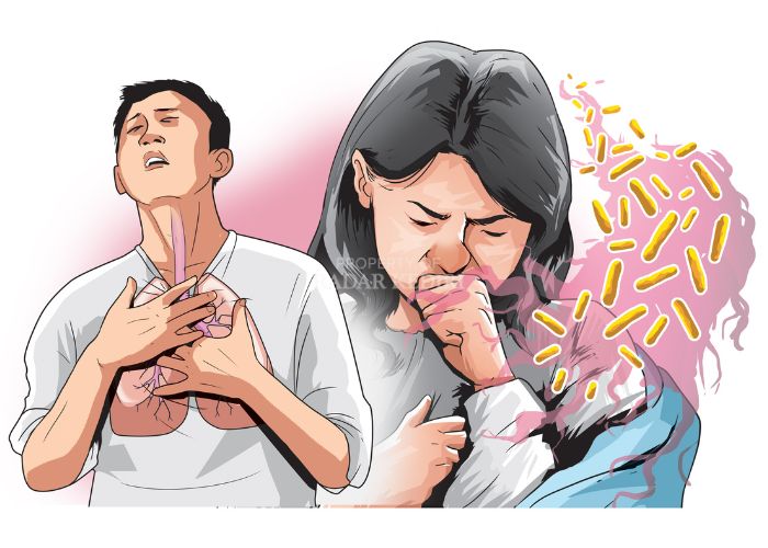 Ilustrasi penderita TBC.