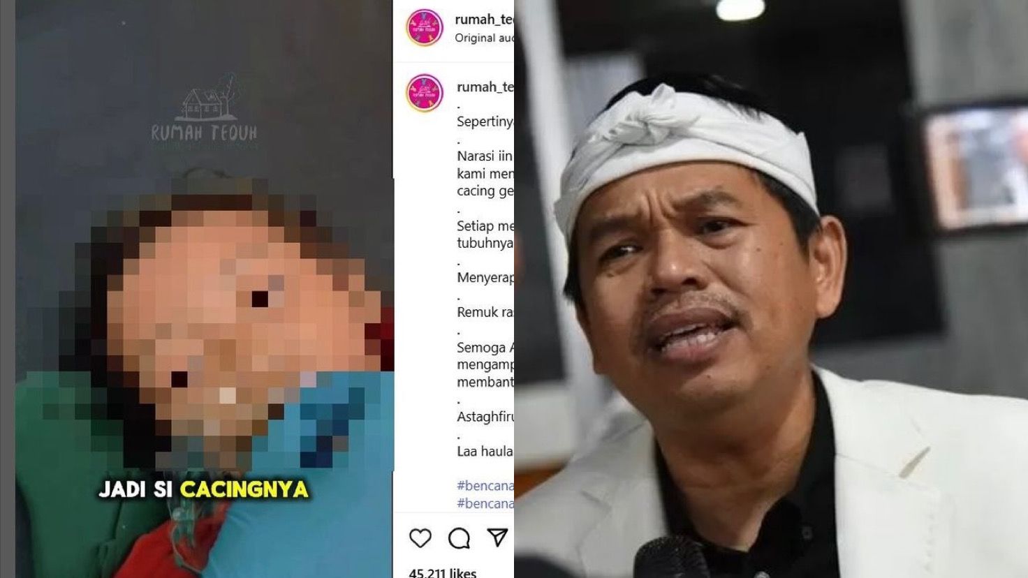 Gubernur Jawa Barat Dedi Mulyadi adanya bocah balita yang meninggal dunia karena tubuhnya dipenuhi cacing.