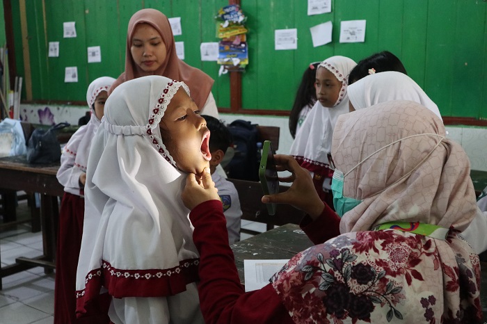 Petugas puskesmas memeriksa kondisi gigi dan mulut siswa dalam cek kesehatan gratis (CKG) di SDN Burengan 3 (16/9).