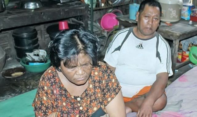 warga-pare-ini-perangi-kebutaan-akibat-glaukoma-bola-mata