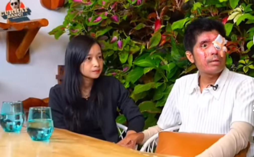 Agus menceritakan kondisinya saat di siram air keras oleh rekan kerjanya.