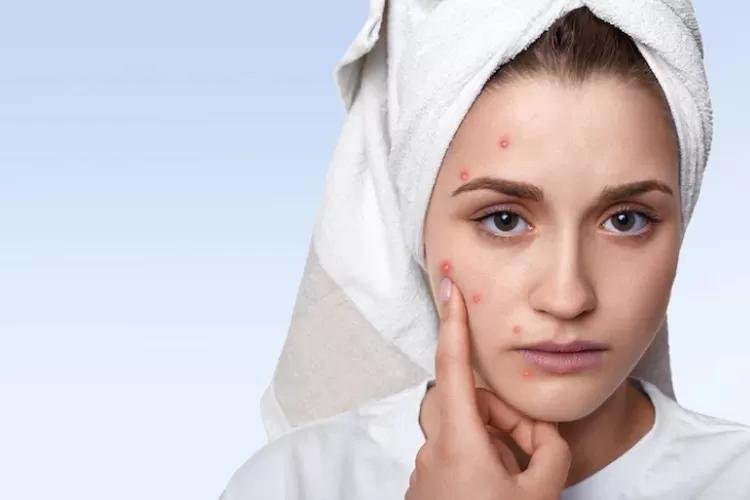 Glow Up Gagal Terus? Cek Dulu, Jangan-Jangan Kamu Masih Begini