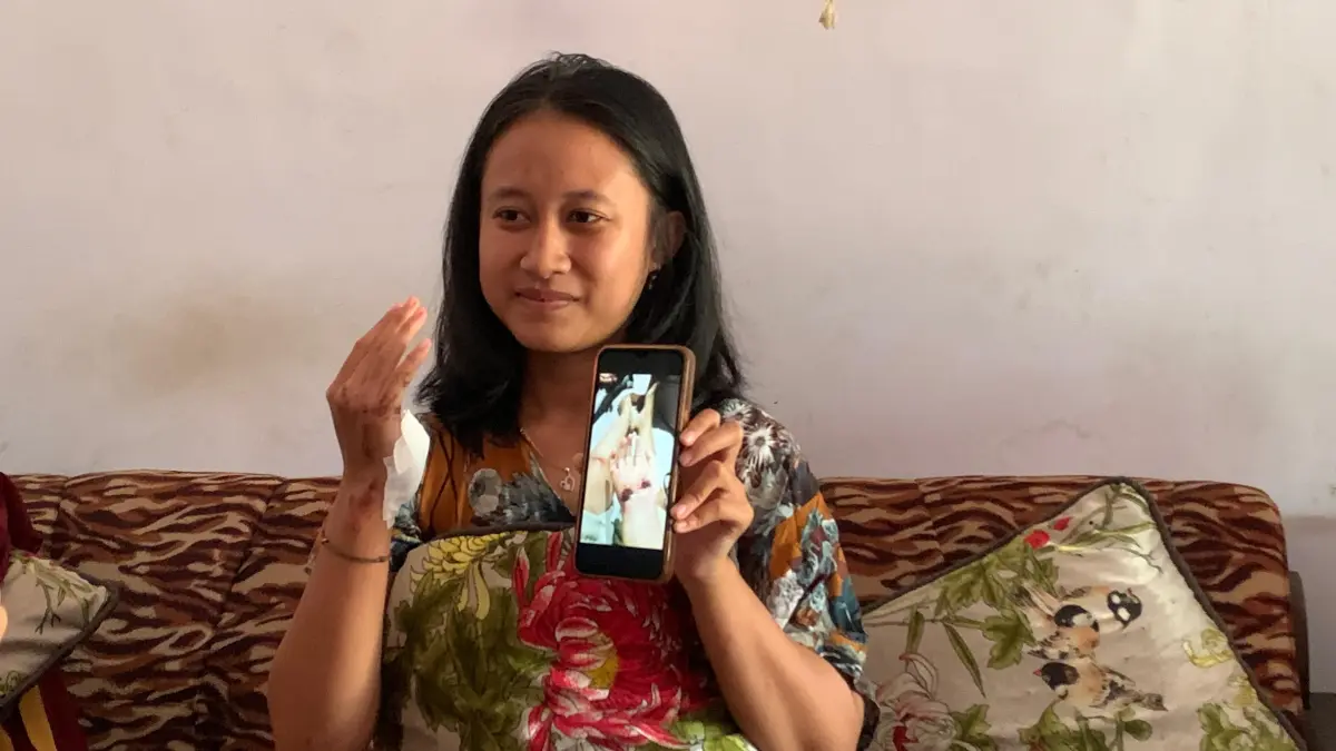 MENAHAN SAKIT: Aurel Aulia Faramesti menunjukan luka pada bagian tangannya, setelah diduga mengalami percobaan pembegalan, kemarin. (ILHAM WAHYUDI/RADAR IJEN)