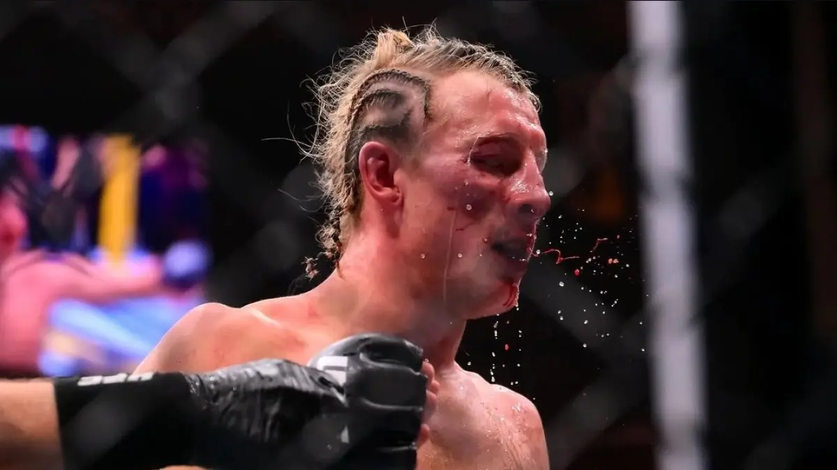 Paddy Pimblett saat proses bertarung denga lawannya (sc:paddypimblett)