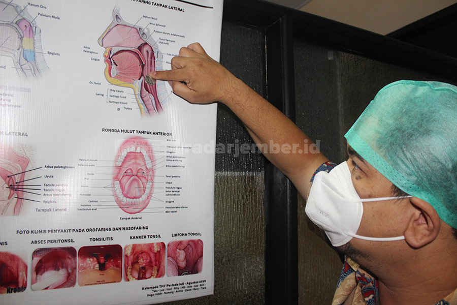 SIMULASI: Dokter Spesialis THT RSD dr Soebandi dr Denny Rizaldi Arianto Sp THT-KL FICS menunjukan contoh benda asing yang masuk ke saluran pernapasan, kemarin (5/2).