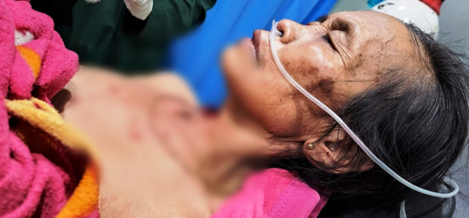 KRITIS: Kondisi Sadima alias Bu Sayati, ibu yang menjadi korban keganasan anak kandungnya sendiri. Lehernya digorok saat korban tertidur pulas.