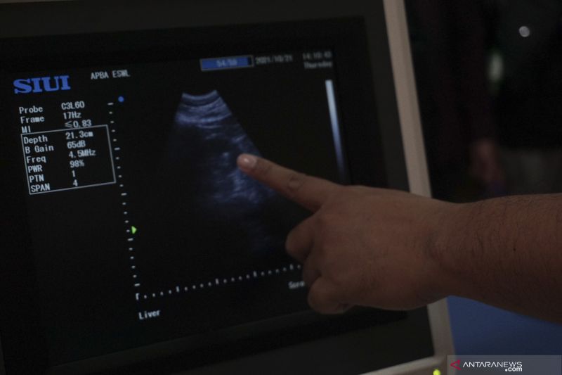 Seorang dokter menunjuk layar monitor hasil pemeriksaan terhadap pasien pengidap penyakit batu saluran kemih di Rumah Sakit QIM, Kabupaten Batang, Jawa Tengah, Kamis (21/10/2021).   