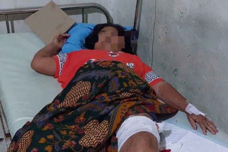 Salah satu korban gigitan beruang liar di Desa Kinarum Kecamatan Upau Kabupaten Tabalong.
