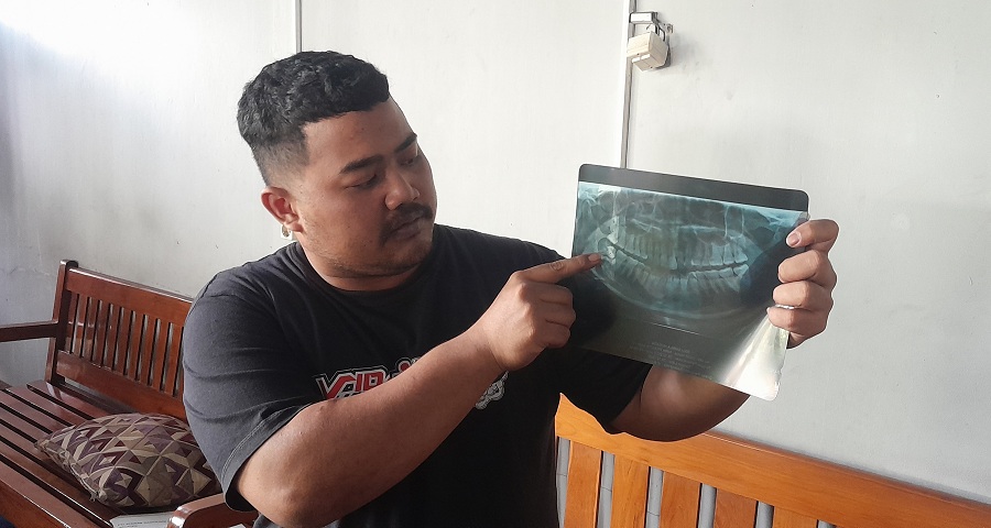 BAKAL TEMPUH JALUR HUKUM: Davin menunjukkan hasil rontgen panoramic mendiang istrinya sebelum cabut gigi.