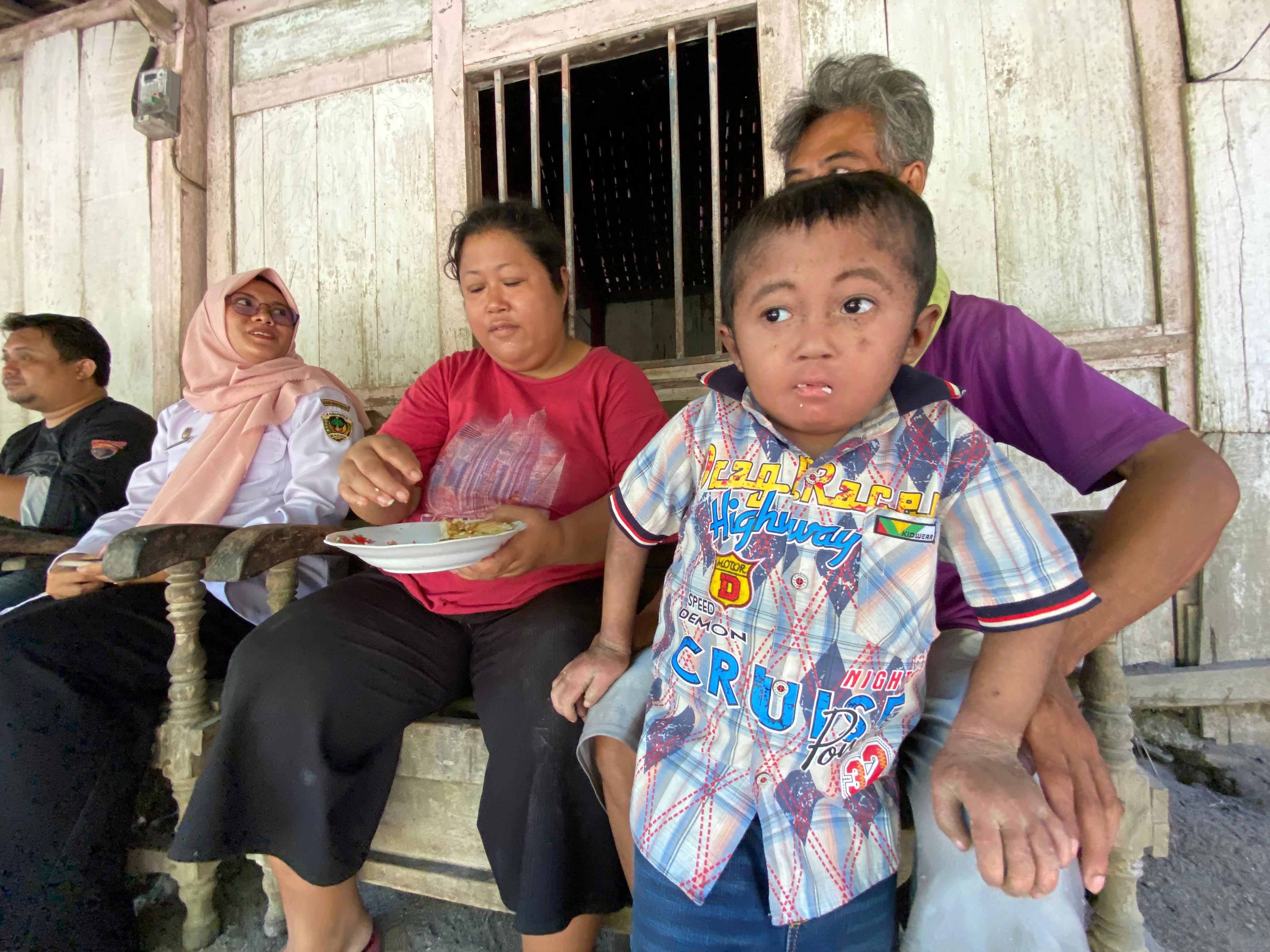 SAKIT: Kondisi Alfi Aska Fahrul Rohim yang mengidap penyakit kulit langka Epidermolysis Bullosa. (DIAN RAHAYU/RADAR MADIUN)