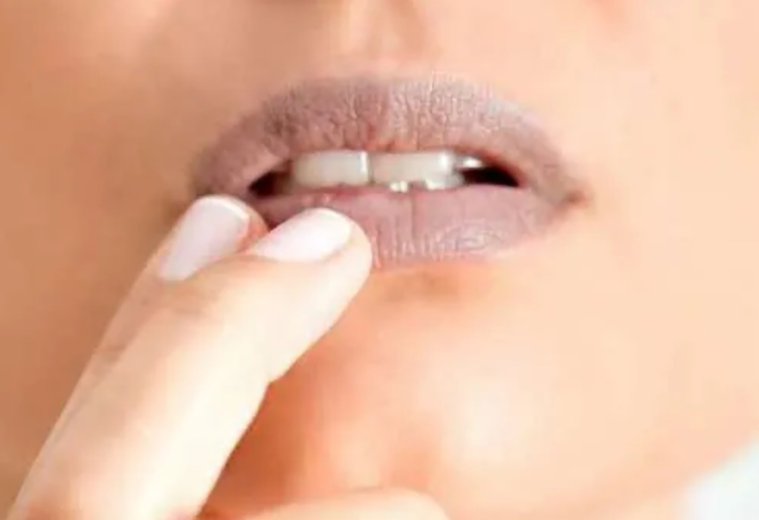 Ilustrasi mengembalikan bibir gelap jadi pink secara alami tanpa lipstik.