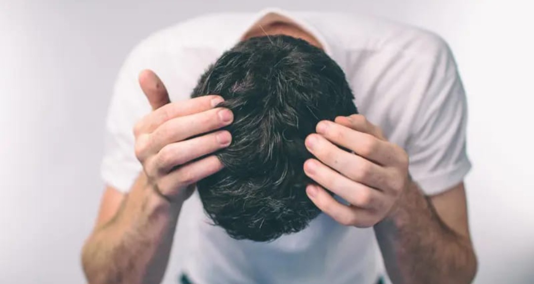 Ilustrasi rambut seorang pria rontok.