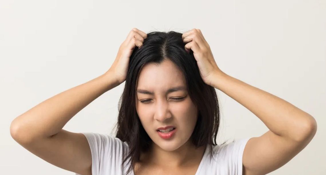 Ilustrasi masalah kesehatan rambut.