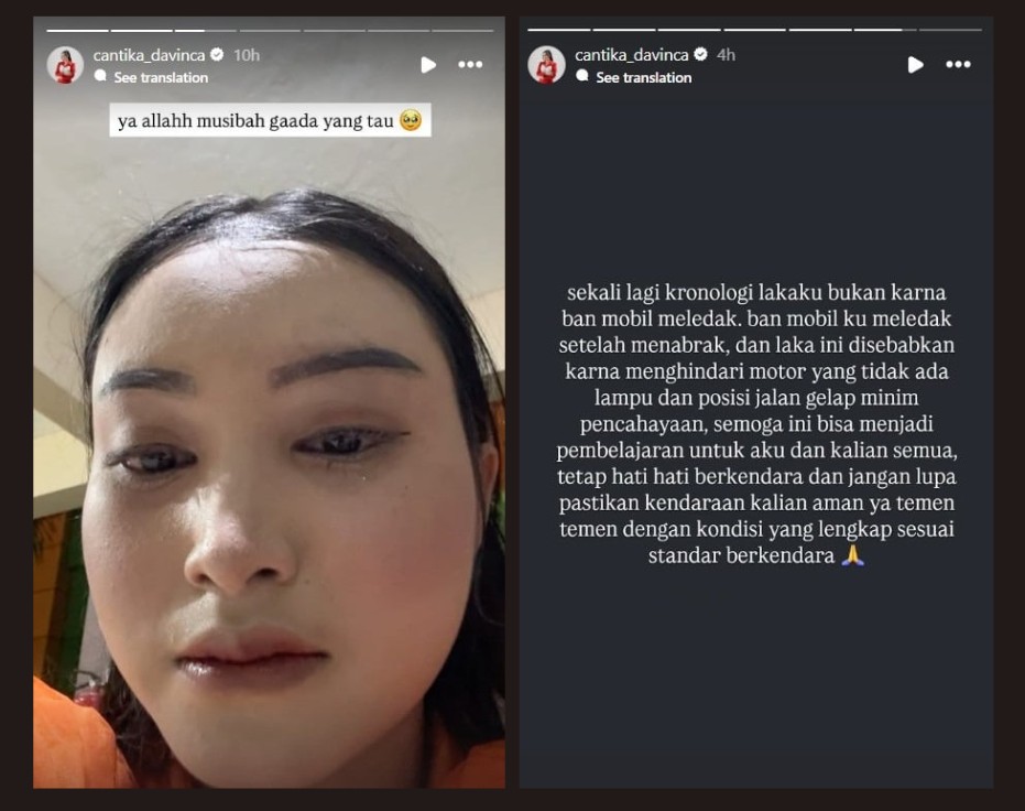 Penyanyi dangdut Cantika Davinca&nbsp;kecelakaan di Magetan.