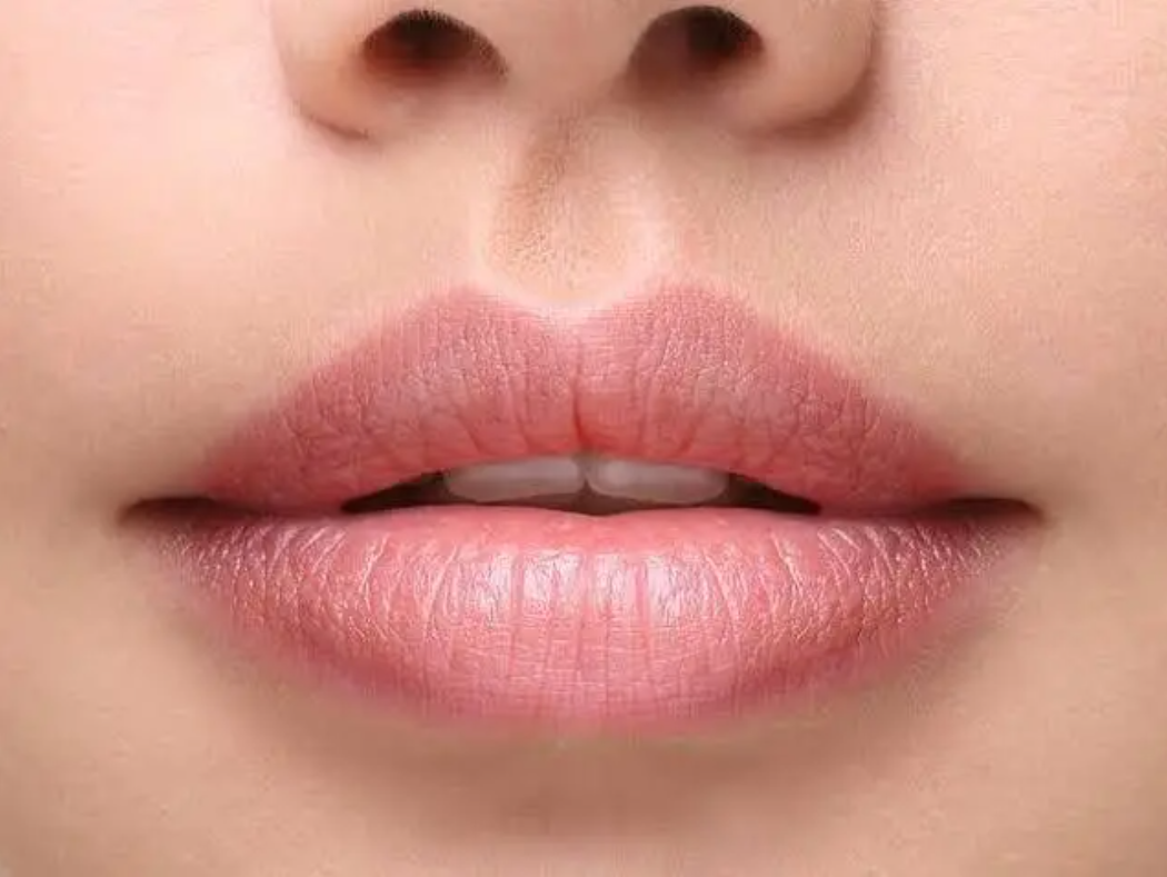 Filtrum adalah lekukan vertikal kecil yang terletak di antara hidung dan bibir atas.