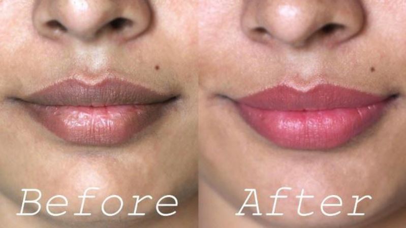 Ilustrasi bibir hitam menjadi cerah dengan lipstik Wardah.